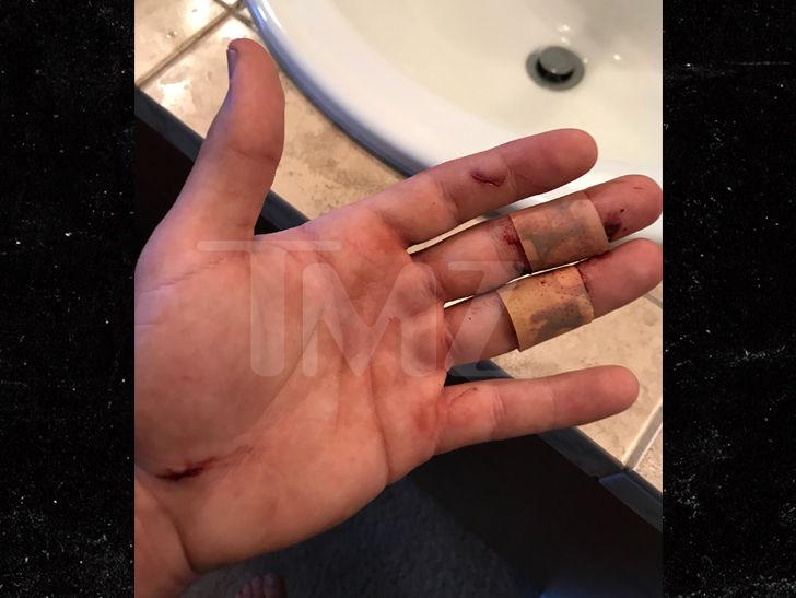 'Jersey Shore' Ronnie's Hand Sliced Deep in VIP