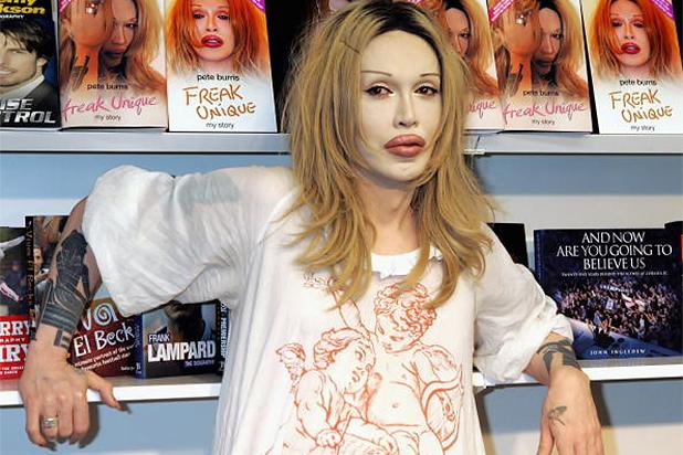 Pete Burns, Dead or Alive Founder, Dies at 57