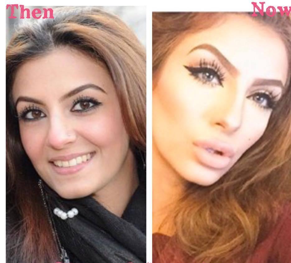 Faryal Makhdoom Before & After Plastic Surgery
