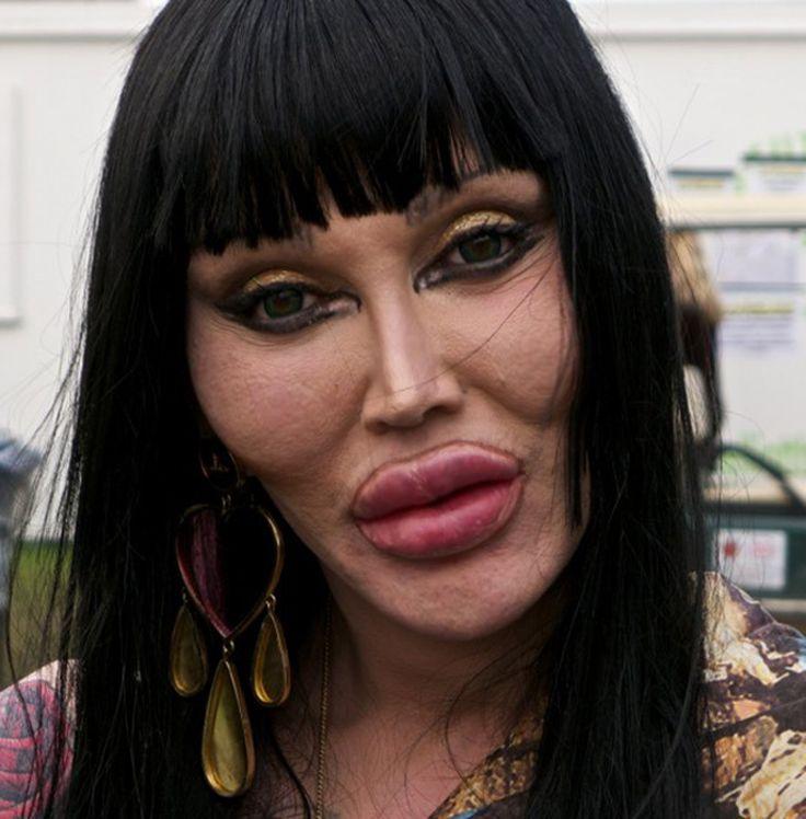 Pete Burns Celebrity Plastic Surgery Gone Wrong Good Celebrity