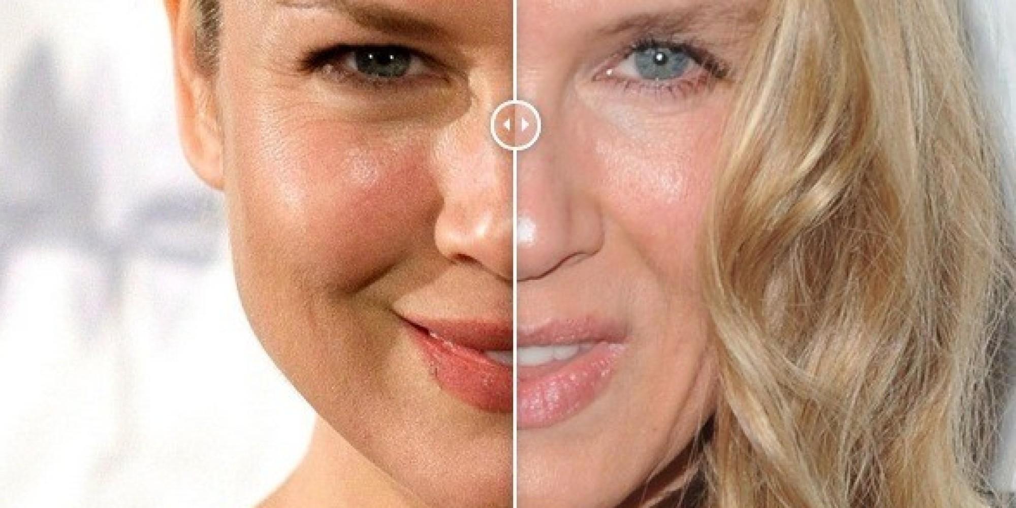 See Ren    E Zellweger's Face Change Before Your Very Eyes