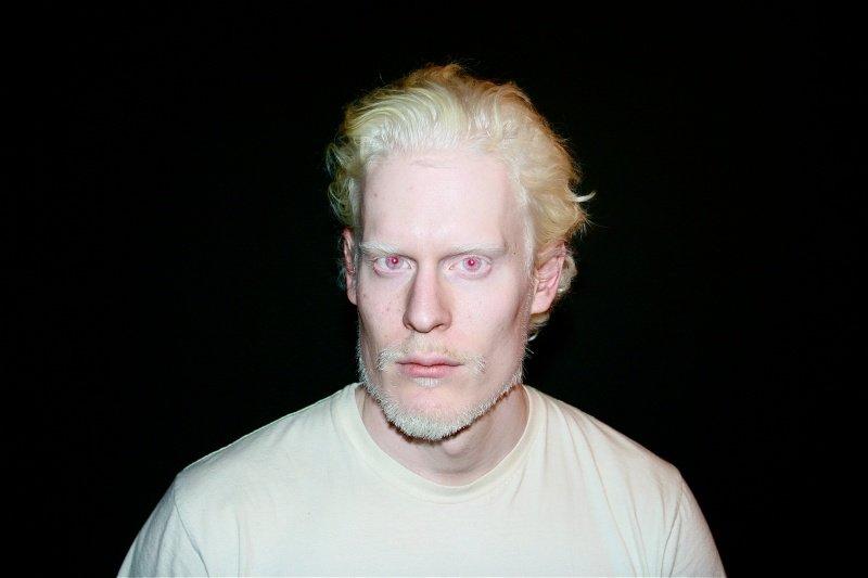 Stephen Thompson, Albino Model And Models On Pinterest