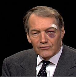 Why Charlie Rose Has A Black Eye